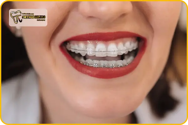 مشکلات ارتودنسی بزرگسالان