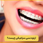 ارتودنسی سرامیکی چیست؟