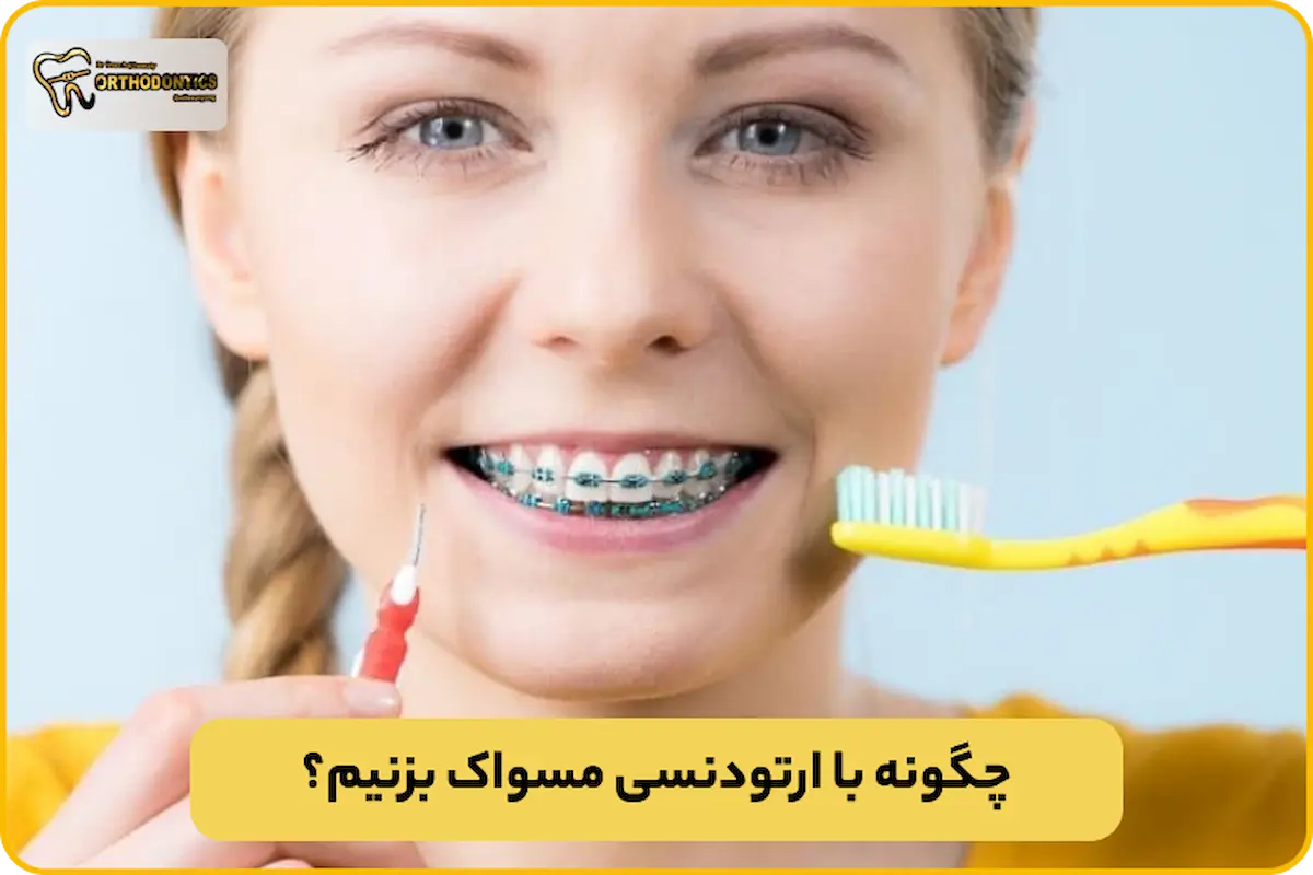 مسواک زدن با ارتودنسی