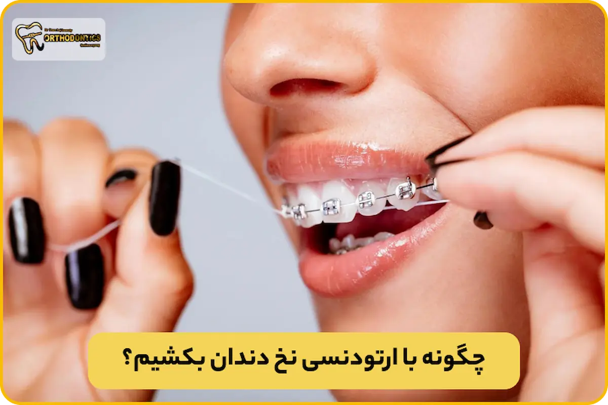 نخ دندان با ارتودنسی