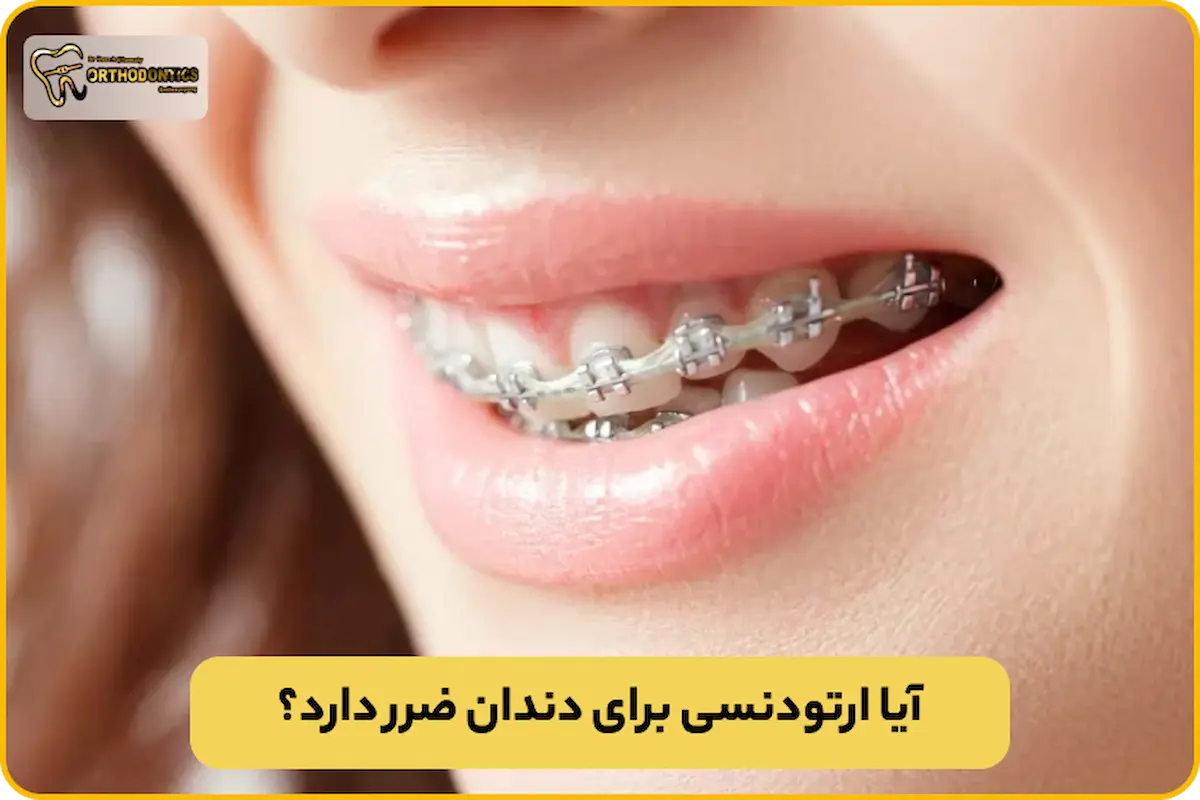 ارتودنسی برای دندان ضرر دارد