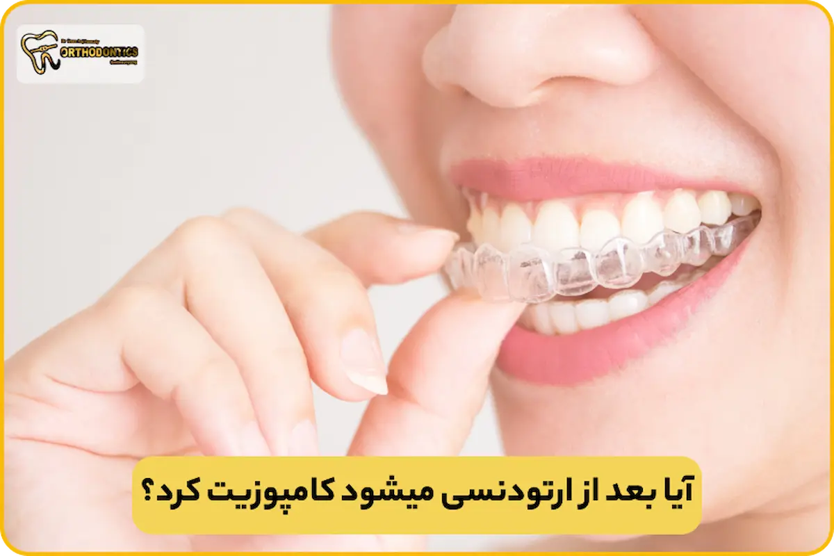 بعد از ارتودنسی میشود کامپوزیت کرد