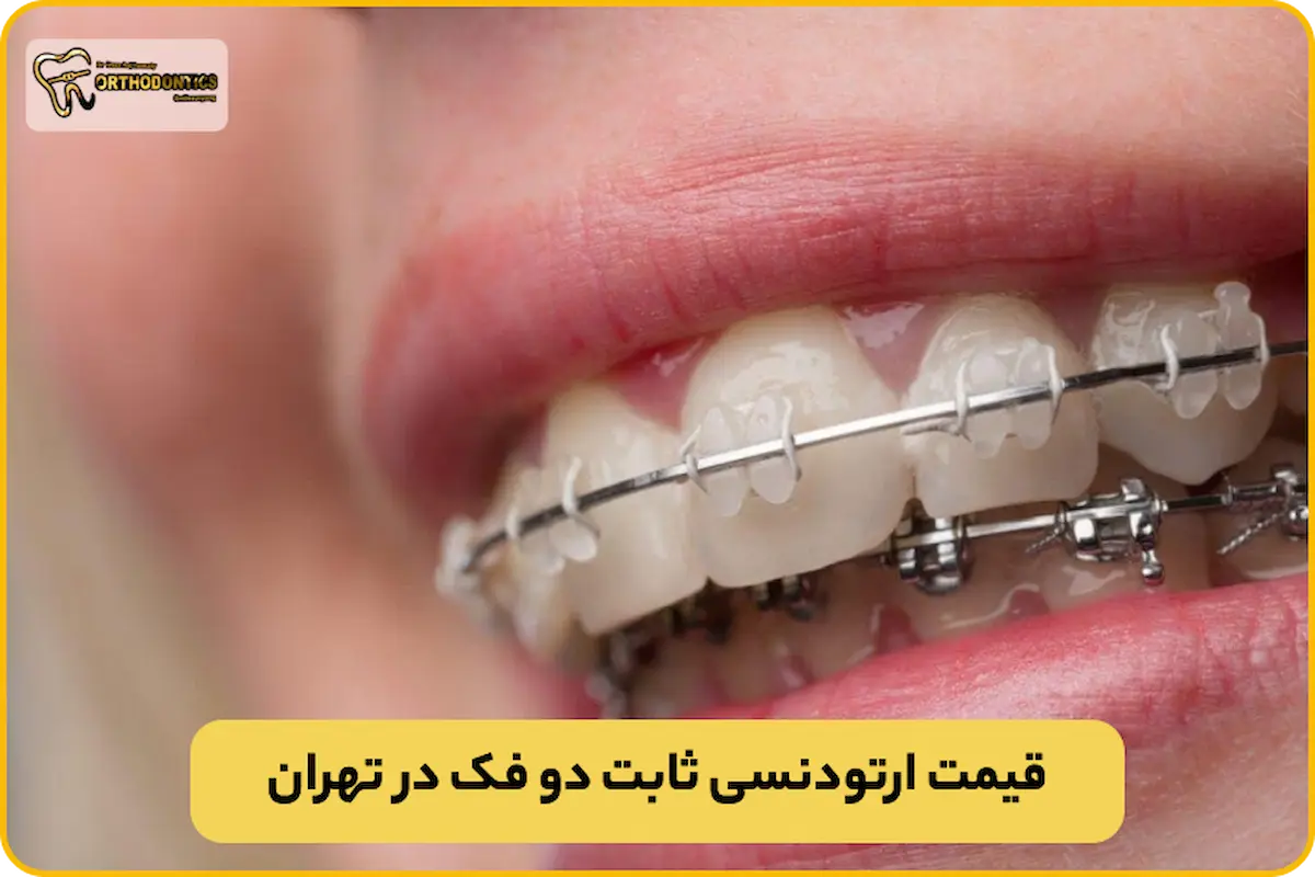 ارتودنسی ثابت دو فک