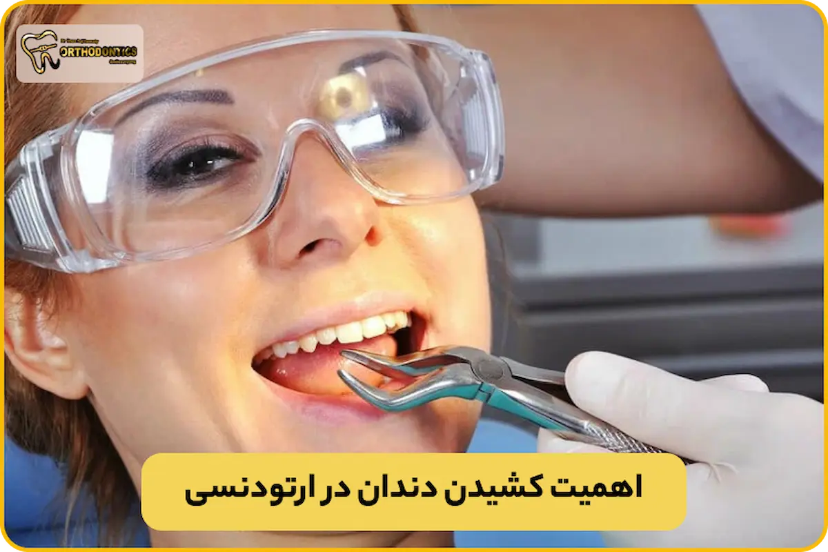 کشیدن دندان 4 در ارتودنسی