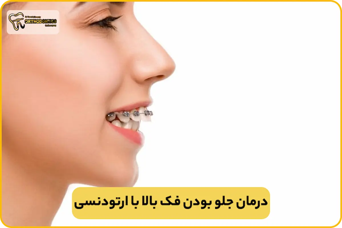 درمان جلو بودن فک بالا در بزرگسالان
