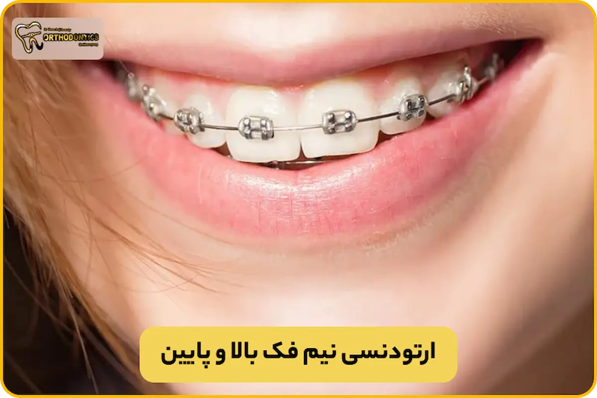 ارتودنسی نیم فک