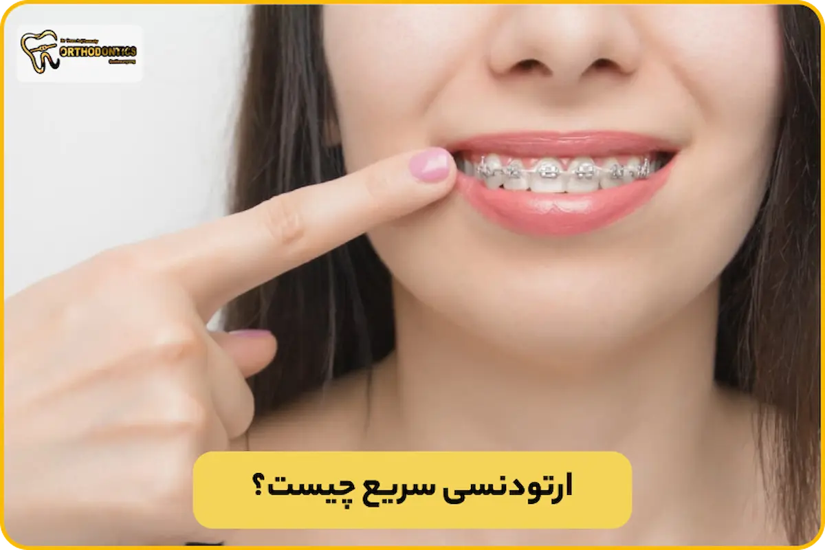 ارتودنسی سریع
