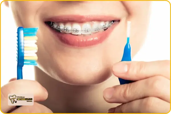 مراقبت های بعد از ارتودنسی