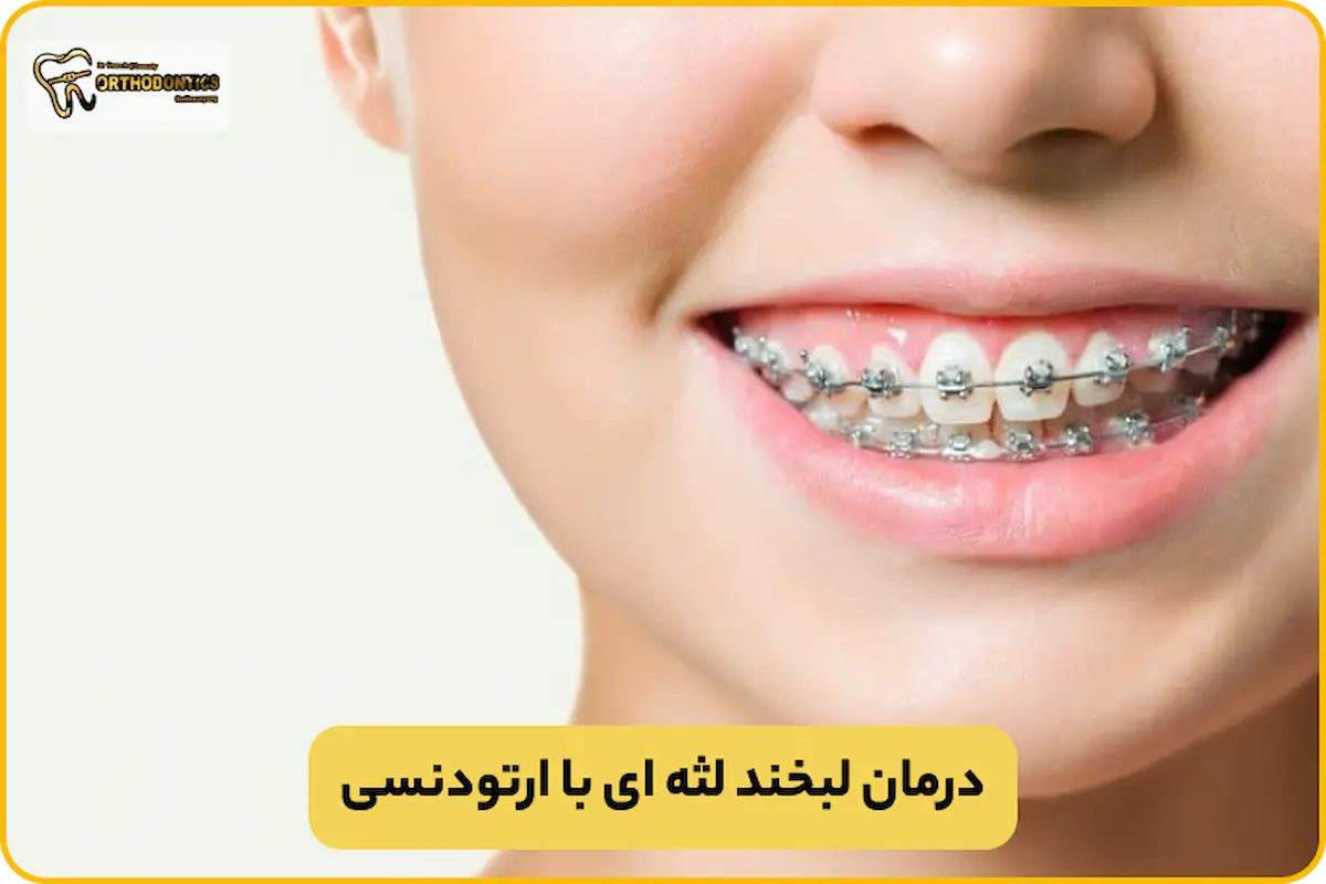 هزینه درمان لبخند لثه ای