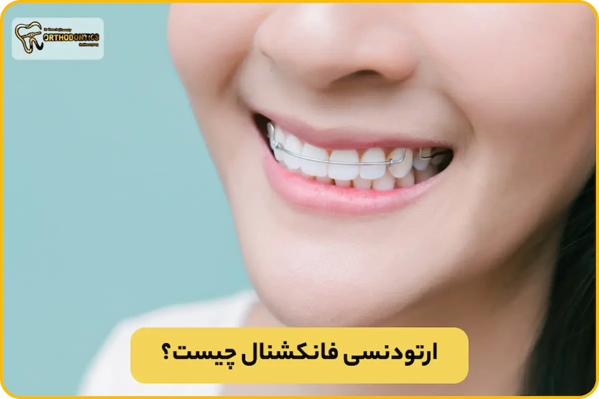 ارتودنسی فانکشنال