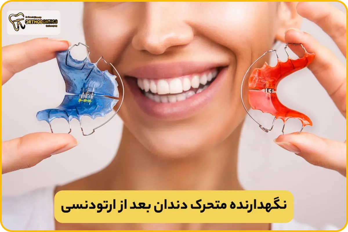 پلاک متحرک بعد از ارتودنسی