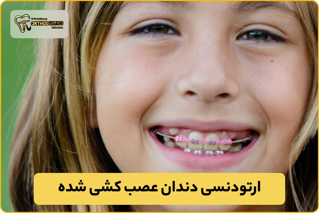ارتودنسی دندان عصب کشی شده