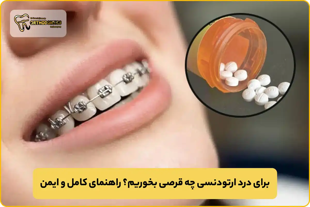 برای درد ارتودنسی چه قرصی بخوریم
