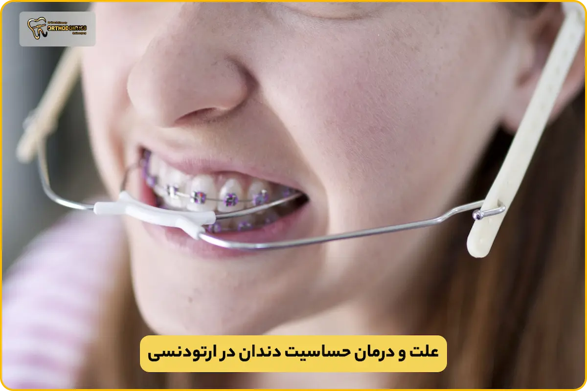 حساسیت دندان در ارتودنسی