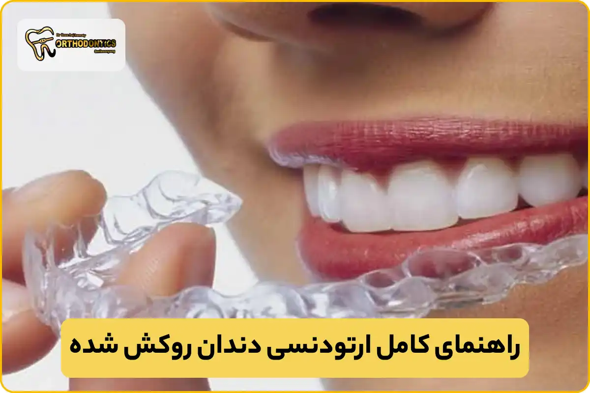 ارتودنسی دندان روکش شده