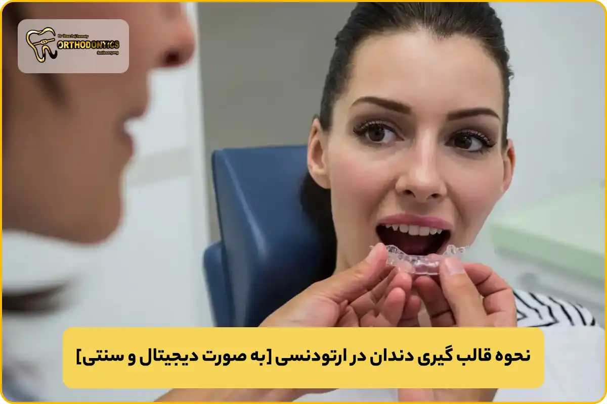 قالب گیری دندان در ارتودنسی