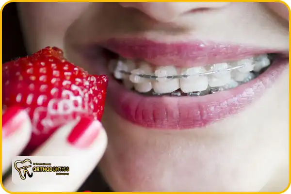 تا چند ساعت بعد از ارتودنسی غذا بخوریم