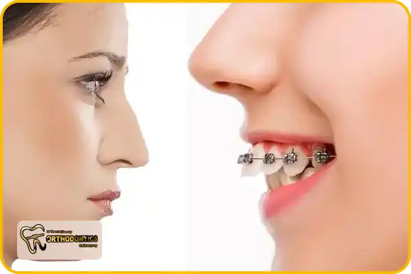 تفاوت جراحی فک و اردودنسی