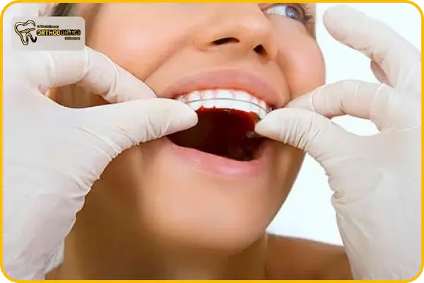 پیشگیری از خارش لثه در ارتودنسی