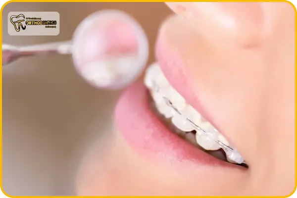 علت خارش لثه در ارتودنسی