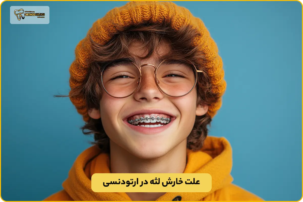 خارش لثه در ارتودنسی