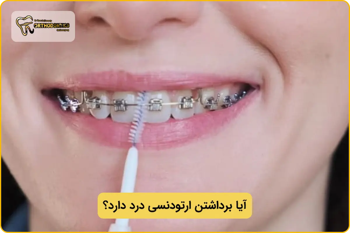 آیا کندن براکت ارتودنسی درد دارد؟