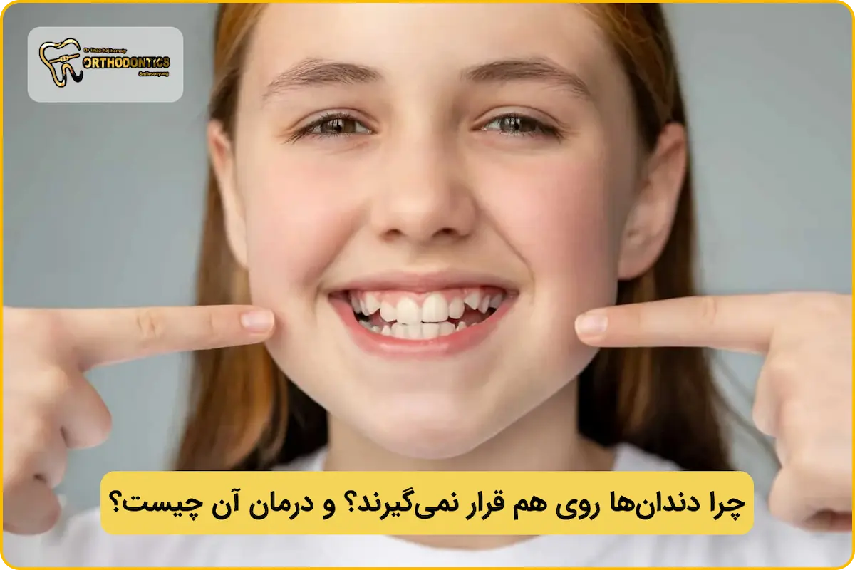 جفت نشدن دندان ها روی هم