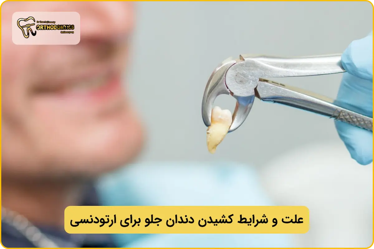 علت کشیدن دندان جلو فک پایین در ارتودنسی
