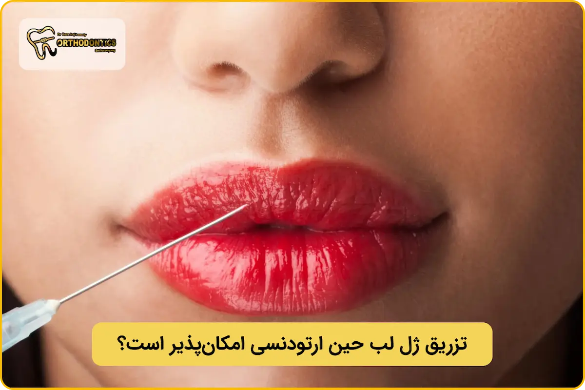 تزریق ژل لب با ارتودنسی