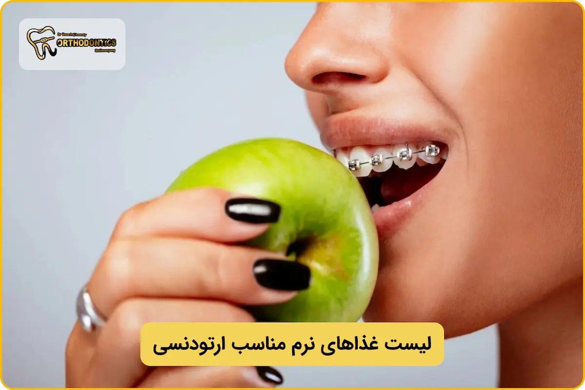لیست غذاهای نرم برای ارتودنسی