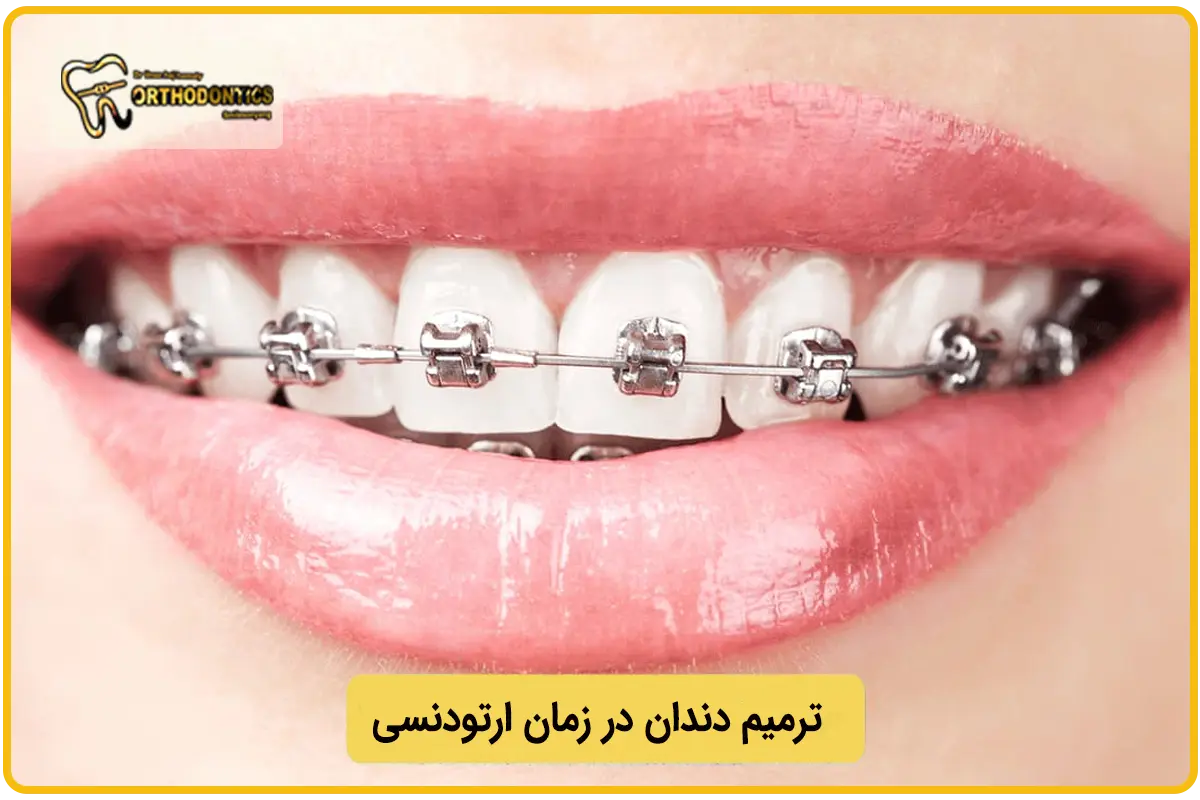 ترمیم دندان قبل از ارتودنسی