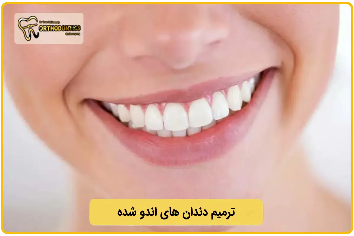 ترمیم دندان اندو شده