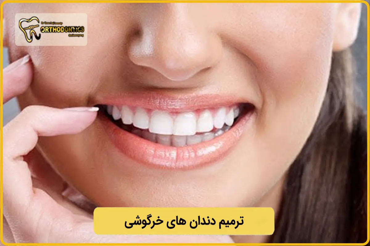 ترمیم دندان خرگوشی