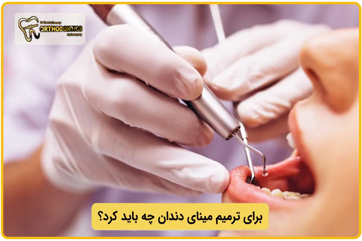 روش های ترمیم مینای دندان