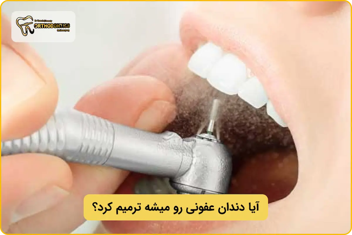 ترمیم دندان عفونی