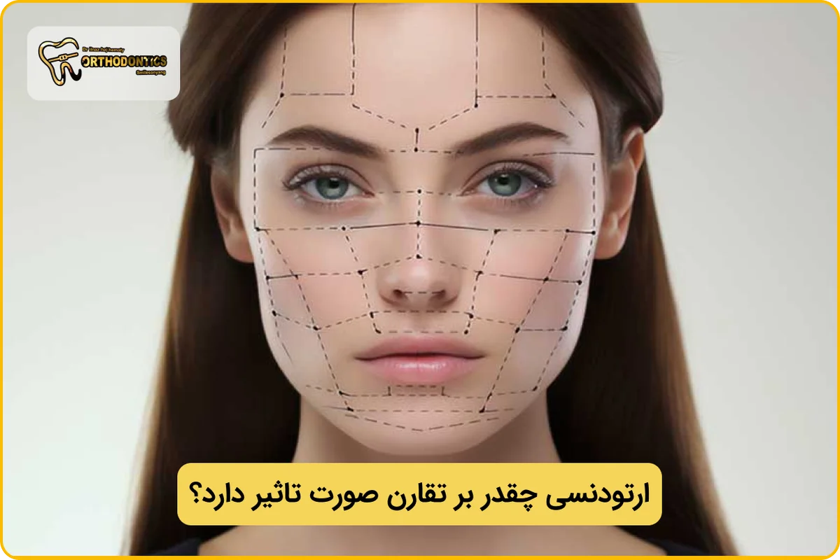 تاثیر ارتودنسی بر تقارن صورت