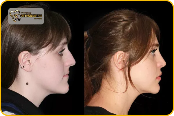 ارتودنسی و تقارن صورت