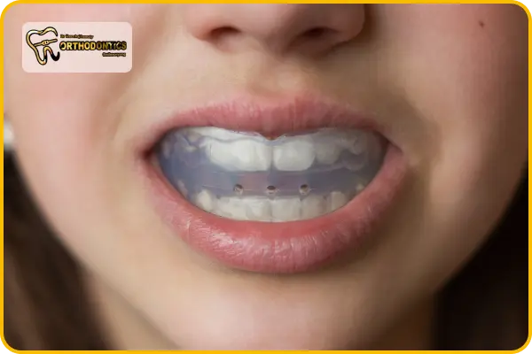 کاربرد بایت پلیت ارتودنسی