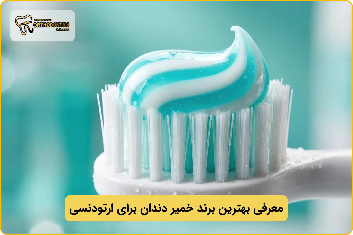 بهترین خمیر دندان برای ارتودنسی