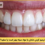 ترمیم دندان با مواد سفید یا سیاه؟ کدام مناسب تر است؟