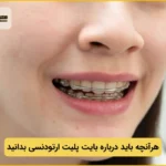 بایت پلیت ارتودنسی چیست؟
