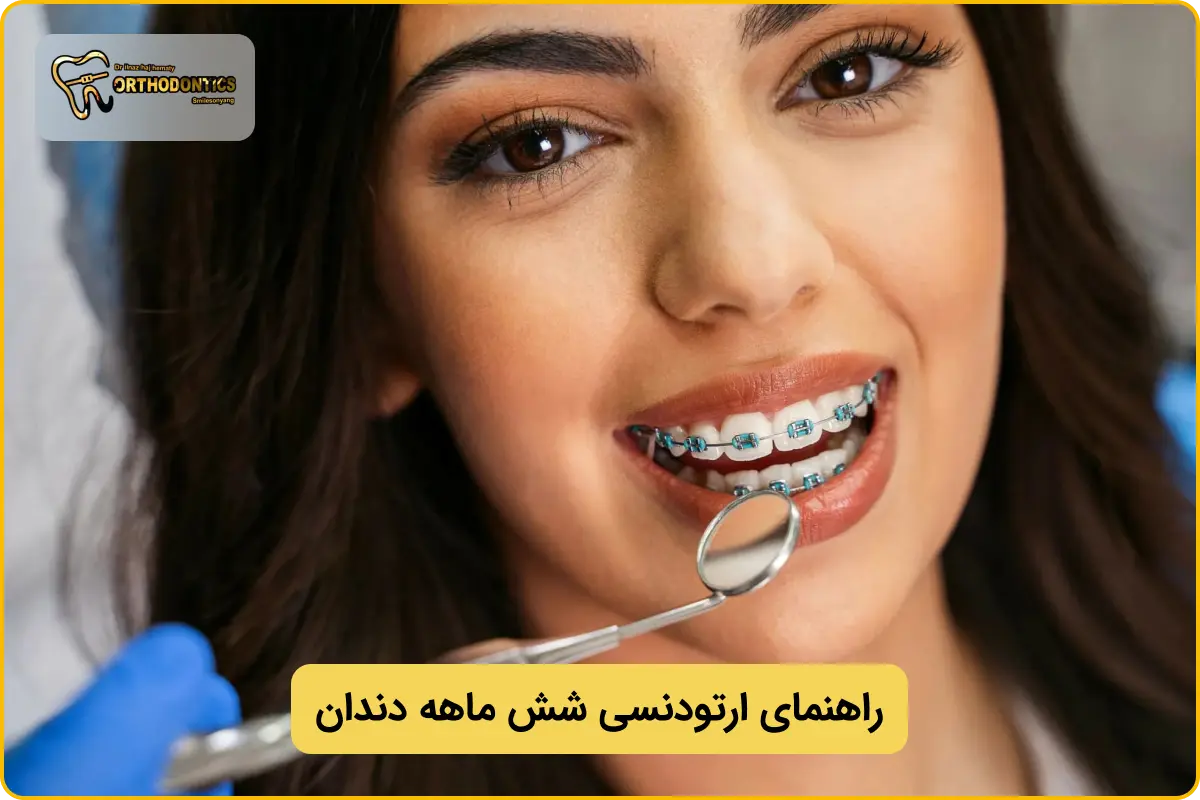 ارتودنسی 6 ماهه چیست؟
