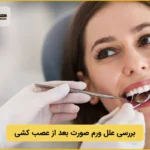 12 علت ورم صورت بعد از ترمیم دندان