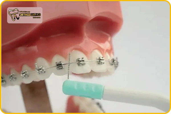 نحوه استفاده از مسواک بین دندانی ارتودنسی