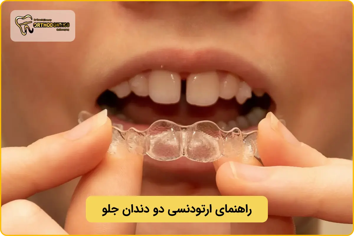 ارتودنسی دو دندان جلو