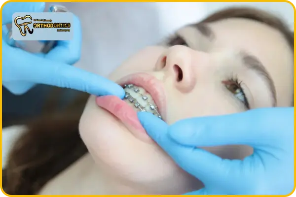 ارتودنسی در سن 30 سالگی