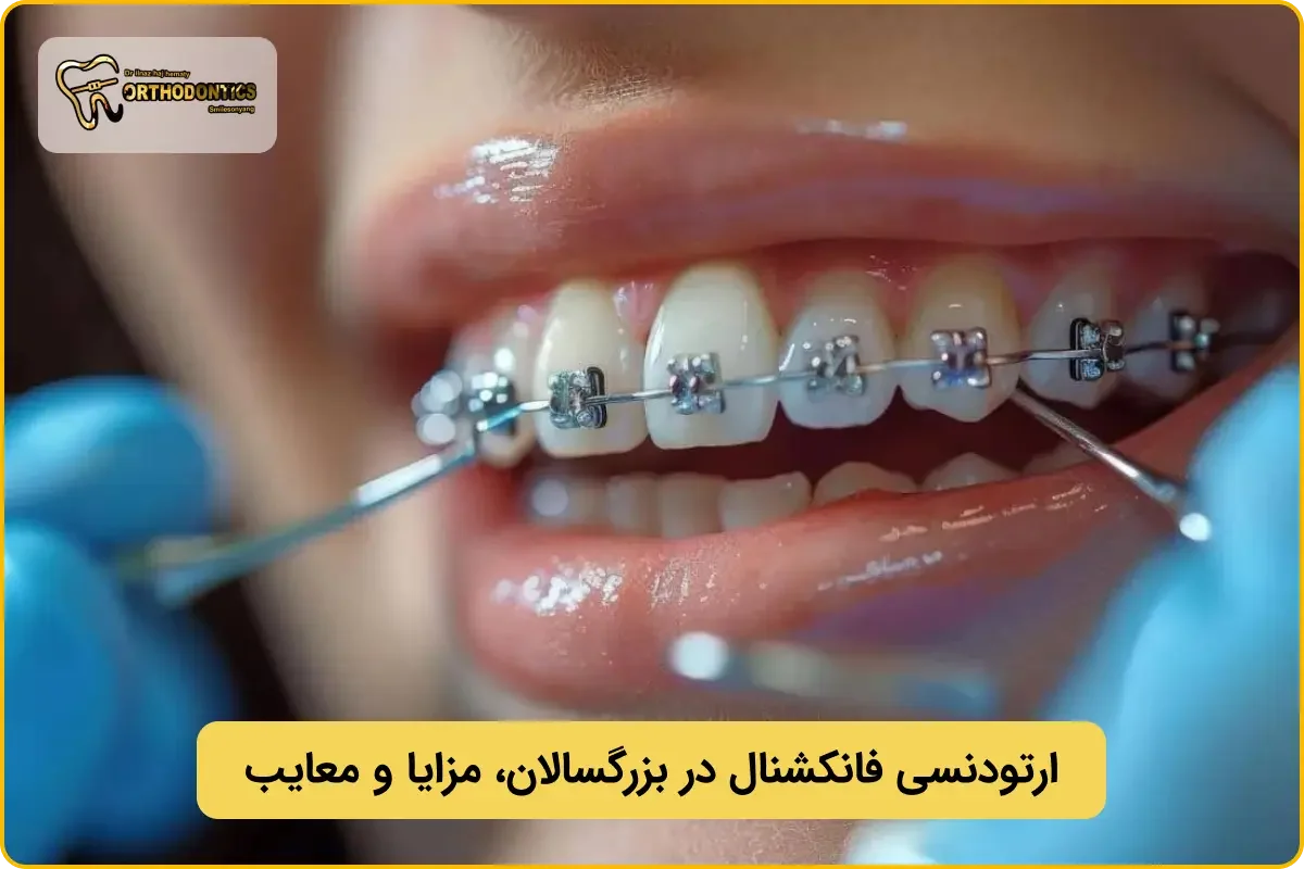 ارتودنسی فانکشنال برای بزرگسالان