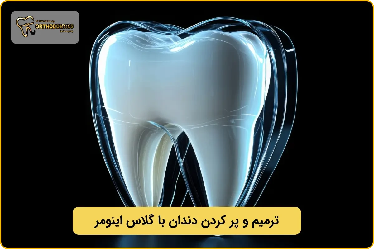 ترمیم دندان با گلاس اینومر