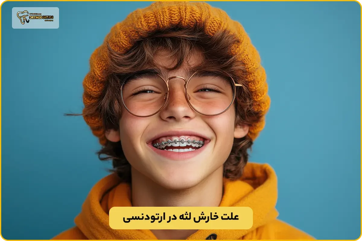 خارش لثه در ارتودنسی