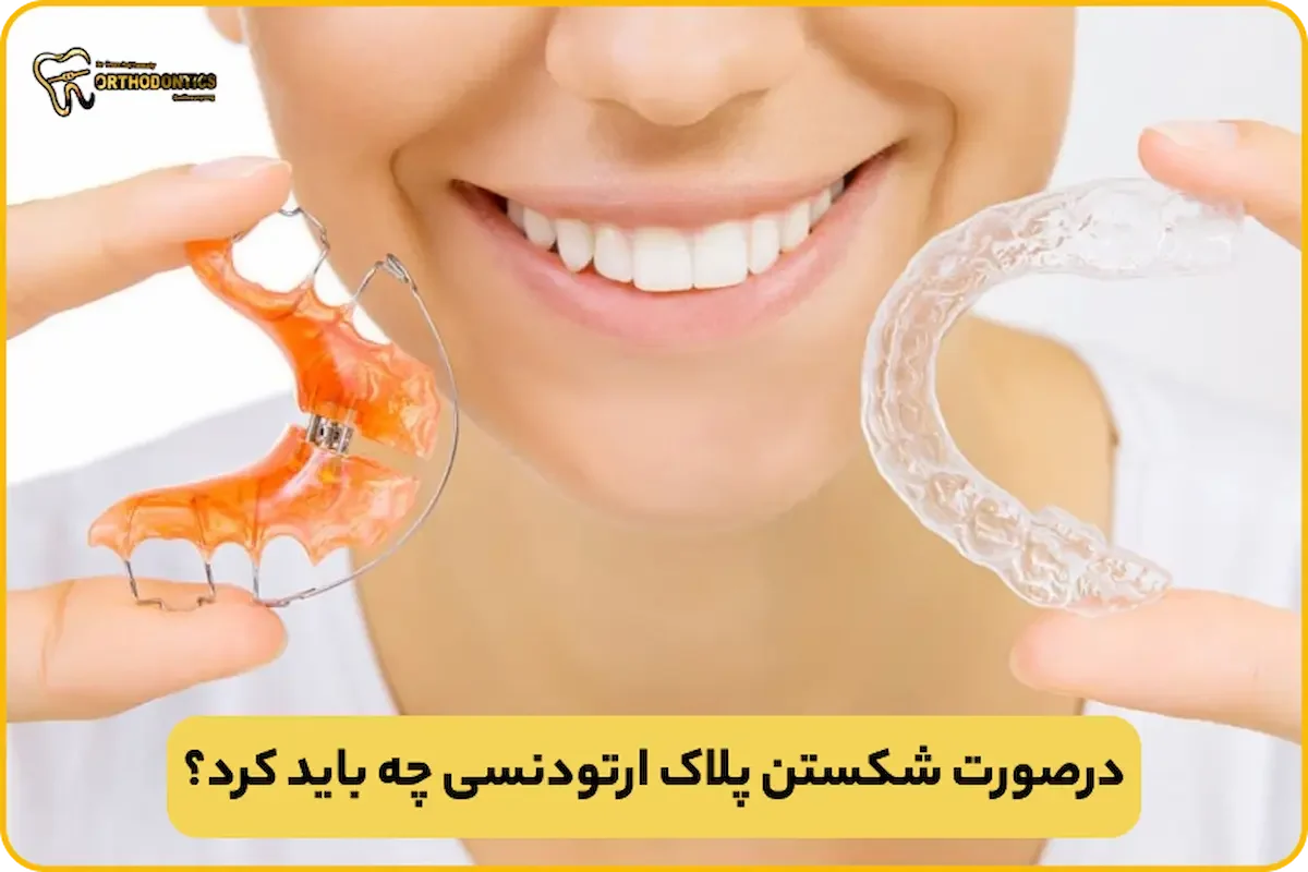 شکستن پلاک ارتودنسی